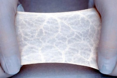 Bioengineered Tissue Scaffold